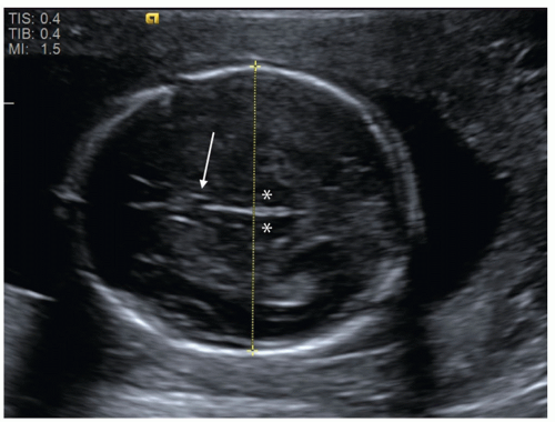 dating ultrasound 12 weeks