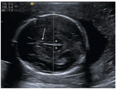 Dating ultrasound 12 weeks